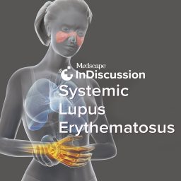 Artwork for Medscape InDiscussion: Systemic Lupus Erythematosus